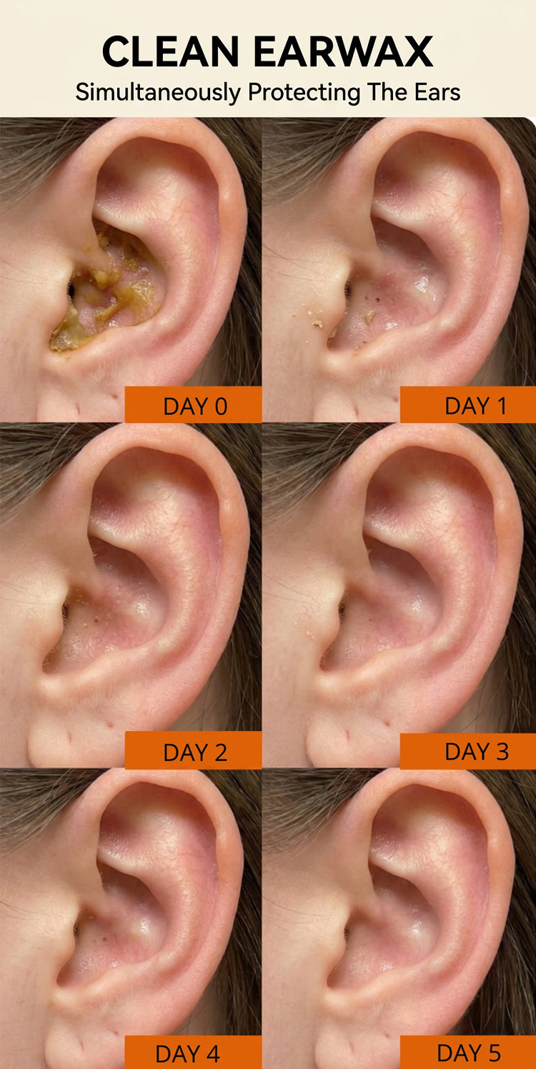 Safe Ear Wax Cleaner - Gentle Ear Cleaning Tool for Quick Wax Removal