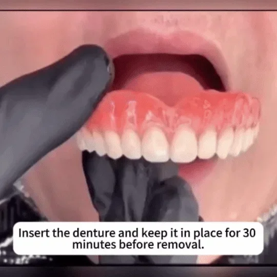 Premium Full Dentures - Comfortable Complete Tooth Replacement Set