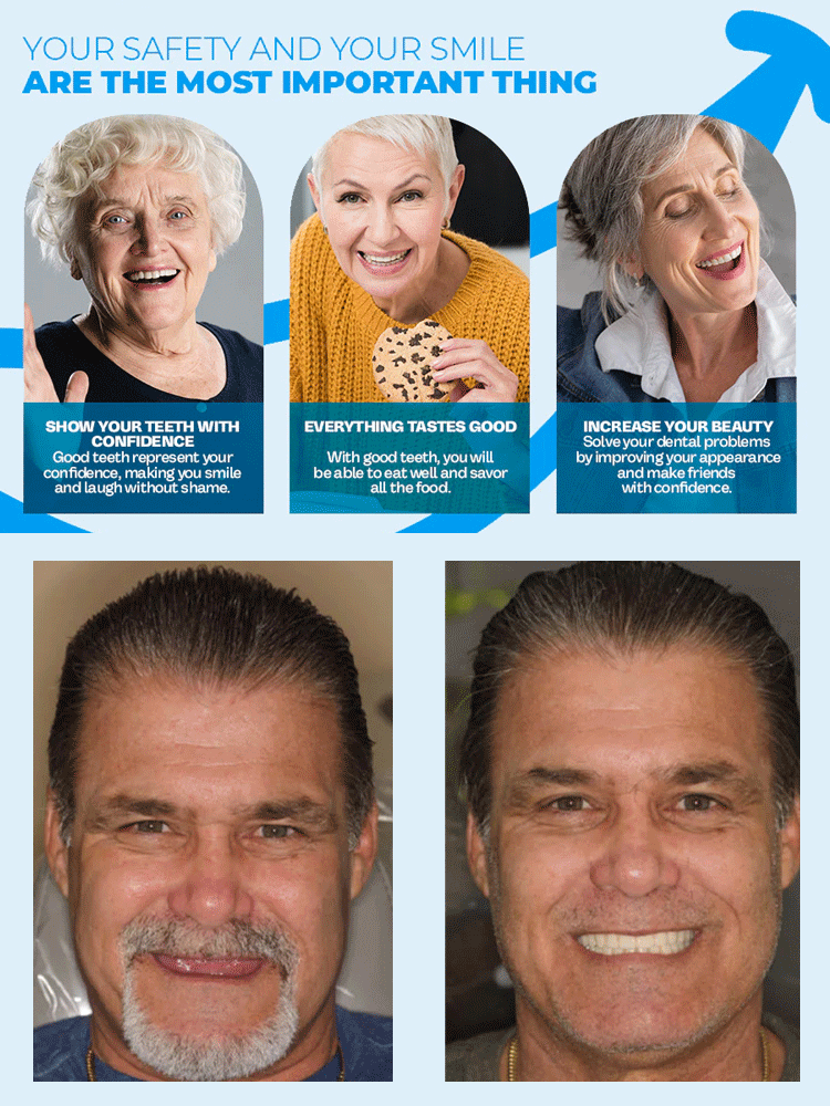 【🦷Buy One Get One Free】Medical-Grade Denture Set✨Hospital-Quality, Safe, Comfortable, and Perfectly Fitting!