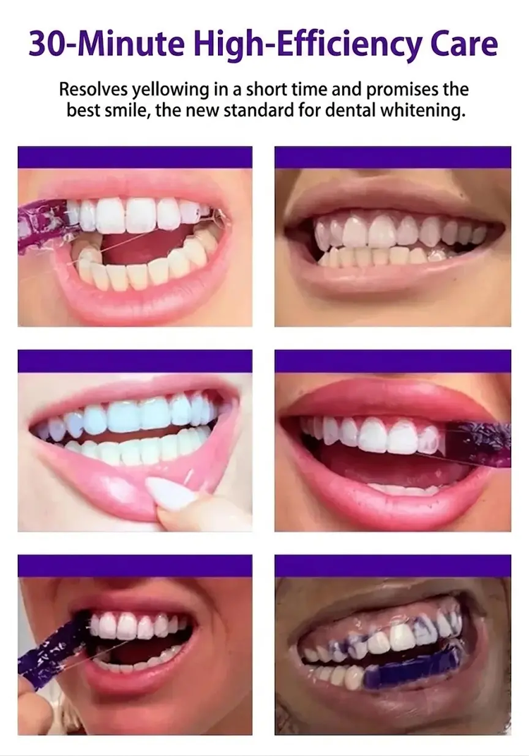 Teeth Whitening Solution - Brighter Smile in 7 Days, Stain Removal in 30 Minutes