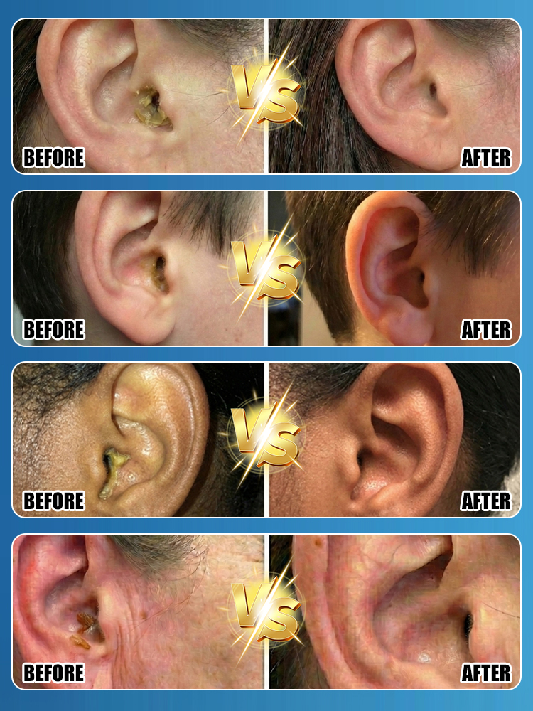 ⚡Stop using dangerous cotton swabs! Clear years of earwax safely in seconds.