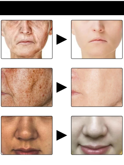 Melanin Repair Facial Essence