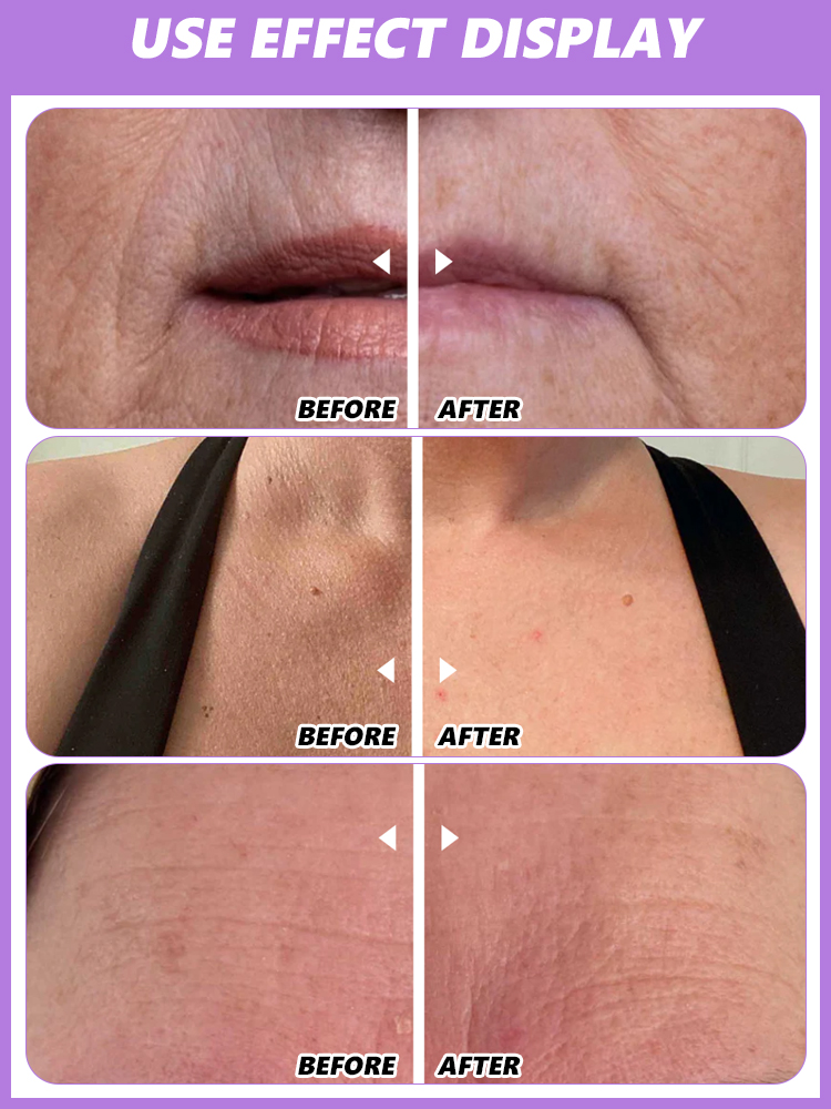 🧴Multi-Effect Skin Renewal and Anti-Wrinkle Stick🌿Repairs fine lines and nasolabial folds🌟Firms skin and brightens dullness with just one application