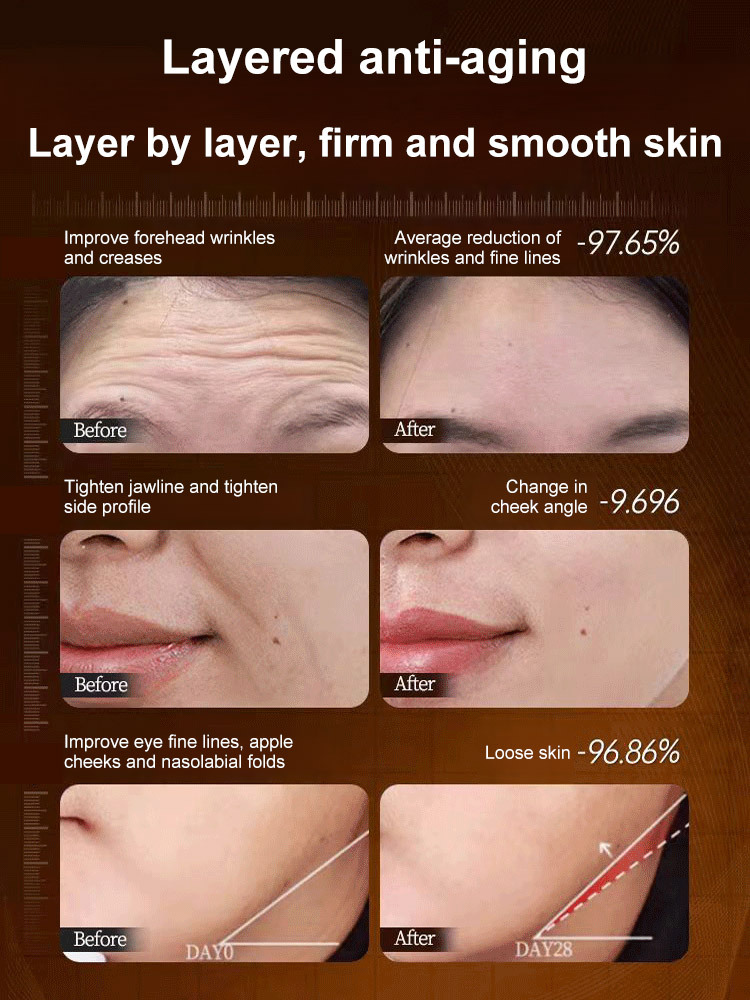 【One touch to remove wrinkles】Micro-molecular collagen anti-wrinkle lotion
