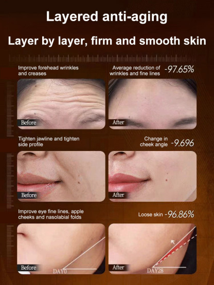 【One touch to remove wrinkles】Micro-molecular collagen anti-wrinkle lotion