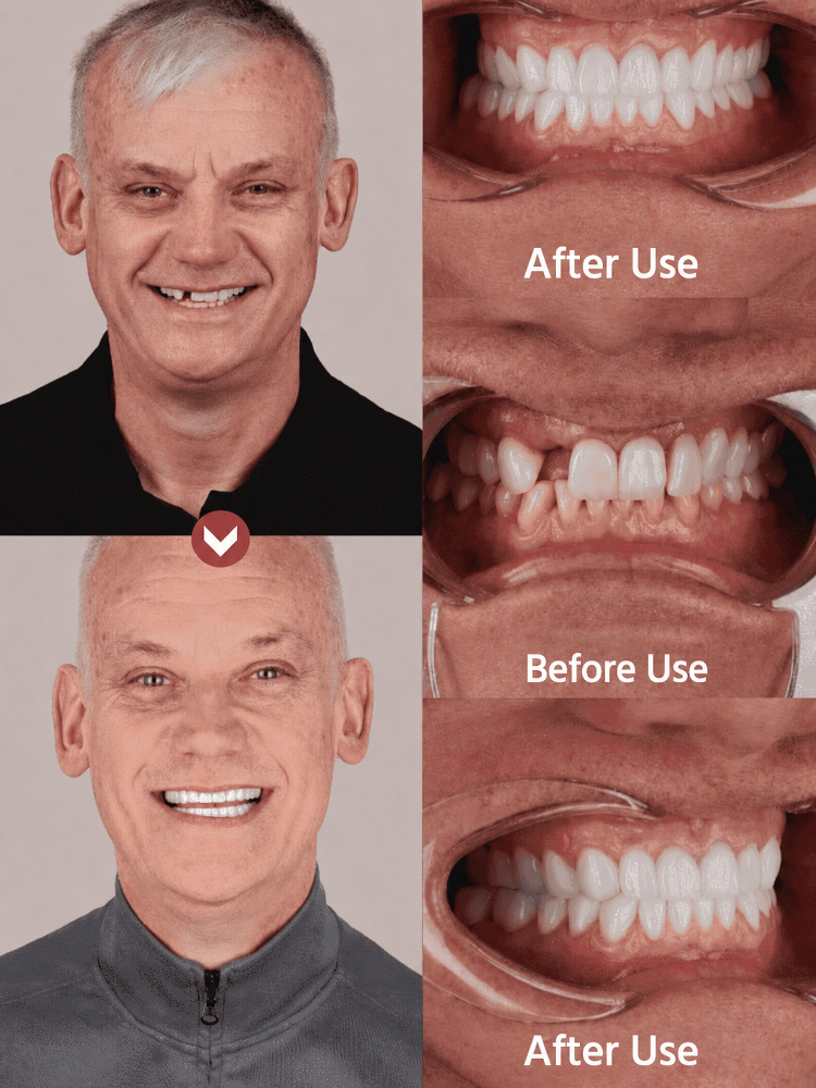 ⚡Stop overpaying your dentist! Get a celebrity smile at home in 1 second.