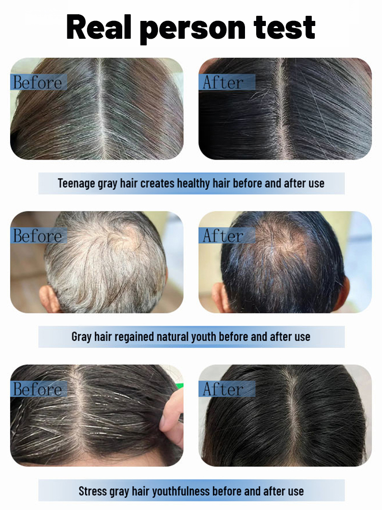 【Perfectly cover gray hair in 5 seconds🔥】Scalp & Root Color Restoring Spray💯Accurately covers gray hair and scalp, making you look natural and youthful!