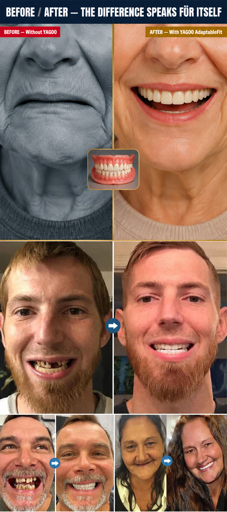 Instant Smile Veneers - At-Home Cosmetic Teeth Cover for a Brighter Smile Appearance