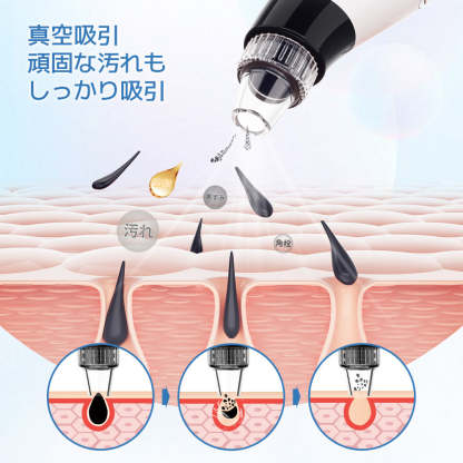 毛穴吸引器