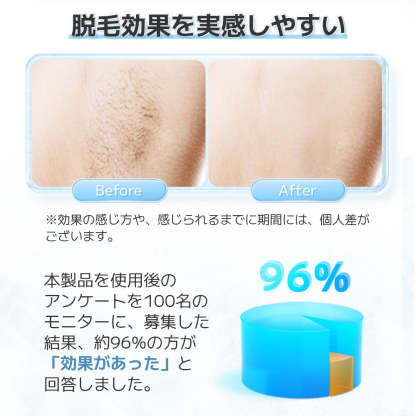 IPL冷感脱毛器 AI07