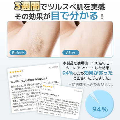 IPL脱毛器 AA0010