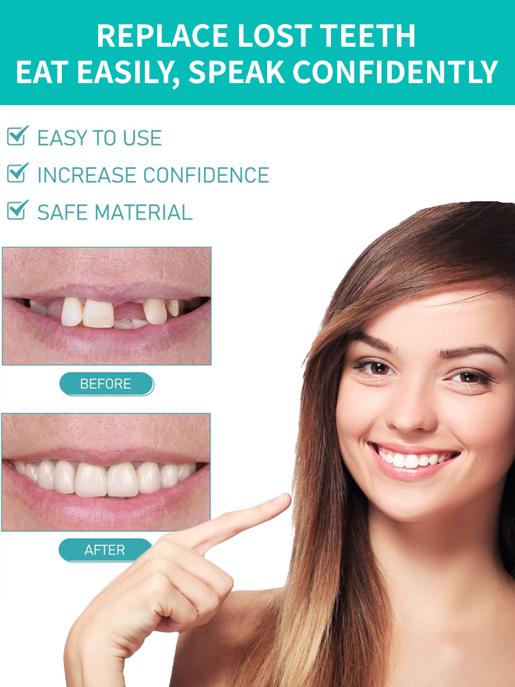 Denture modification kit