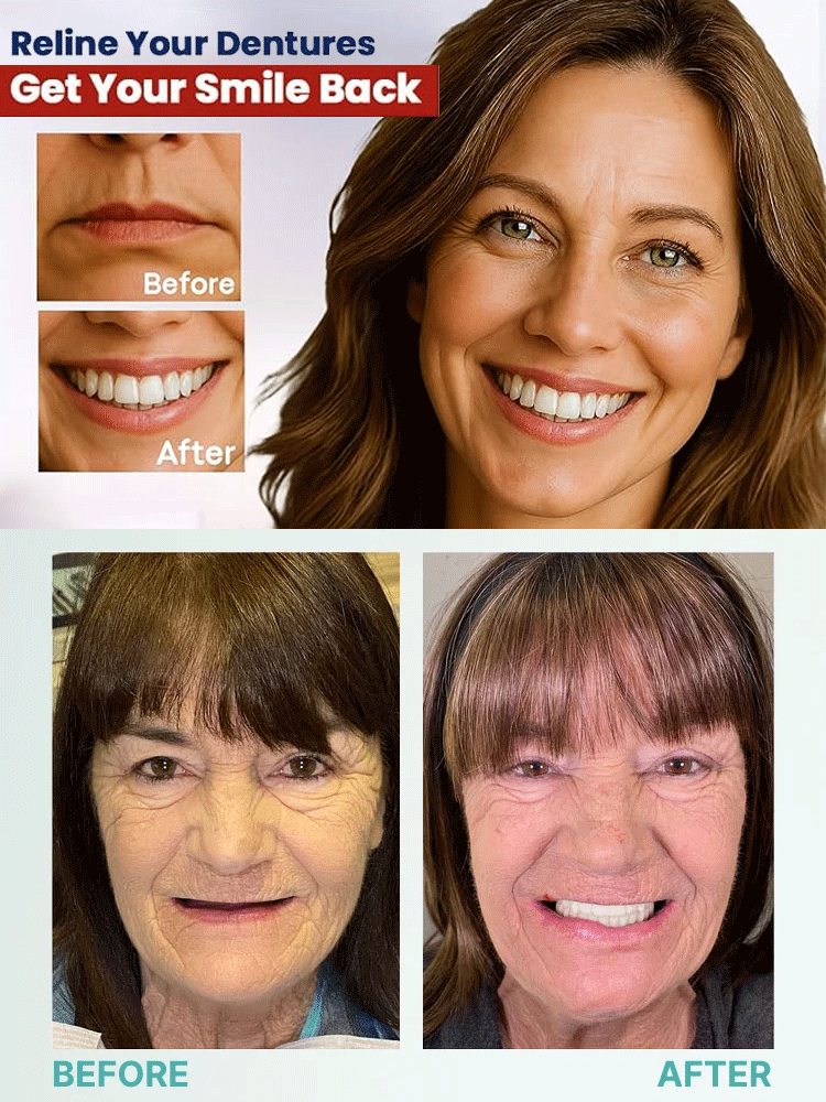 High-end custom-made full dentures【High-end quality, everyone who uses it raves about it!】