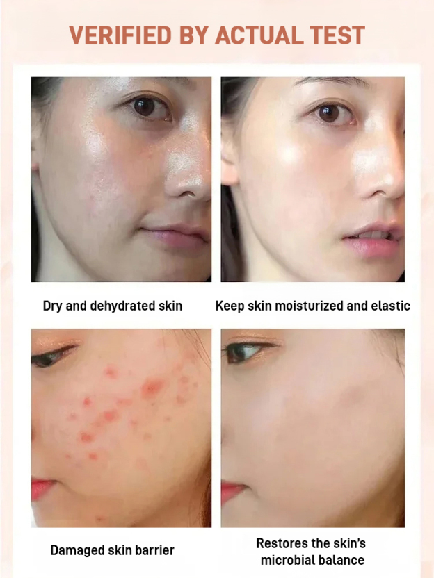 Walnut-Stuffed Dried Figs Snack【Double nutrition for better health!】