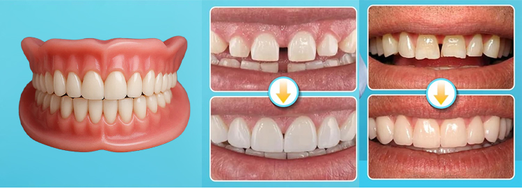 🎁🌎Ends Today: 70% OFF! Yagoo™ Medical Full Denture with Strong Suction^ 🏆 2026 Best Seller