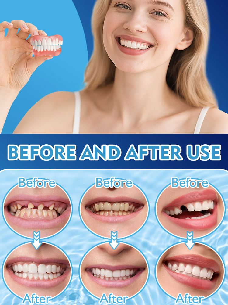Smile Whitening Dentures