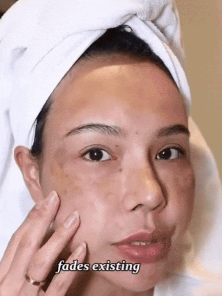 【3 in 1】Whitening, Anti-Blemish and Anti-Wrinkle Essence【See visible results in just 5 days!】