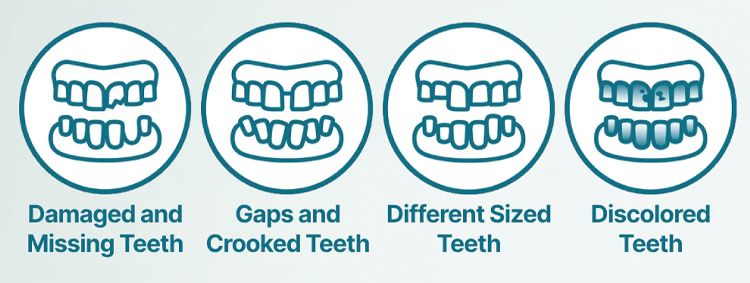 🎁🌎Ends Today: 70% OFF! Yagoo™ Medical Full Denture with Strong Suction^ 🏆 2026 Best Seller