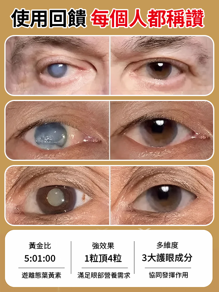 沙棘籽油護眼軟膠囊🔥黑科技问世，一招恢复视力5.0