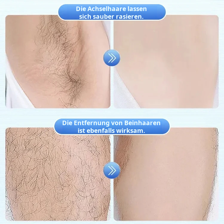 RotaryPro™ Double-Ring Shaver - Smooth, Fast, Reliable