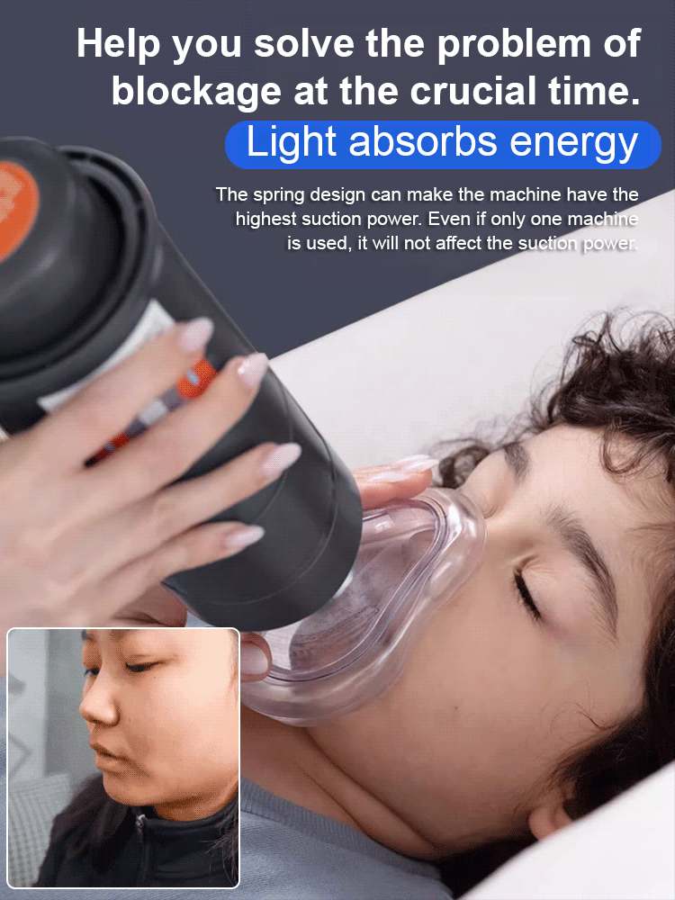 Sonmol Heimlich maneuver, suitable for home use, adults and children, one-button negative pressure suction 33KPA, no pressure required to prevent organ damage, two-way check valve to prevent foreign objects from entering.