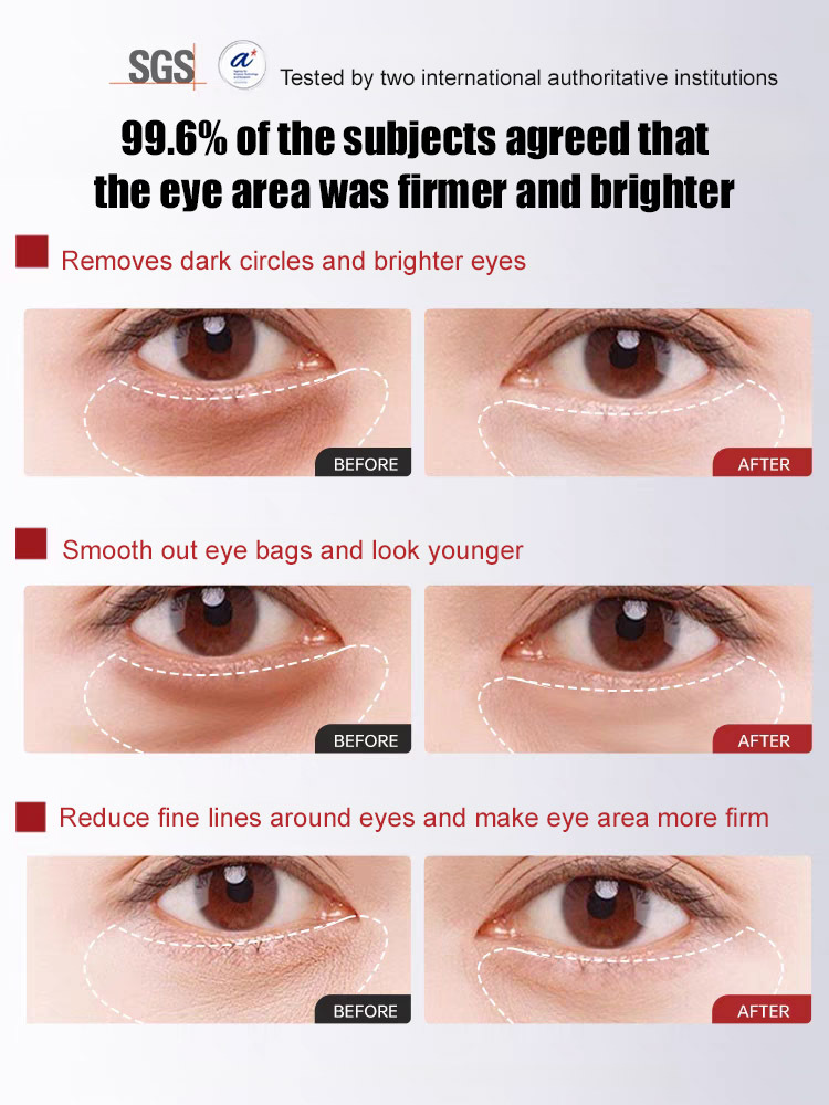 🌸🌸🌸【Herbal Anti-Wrinkle Firming Eye Cream】SGS-certified, reduces fine lines by 99.9%, dark circles by 98.7%, and eye bags by 96.3%. Contains herbs like ginseng and angelica, plus patented ingredients, for a refreshing and easily absorbed finish.