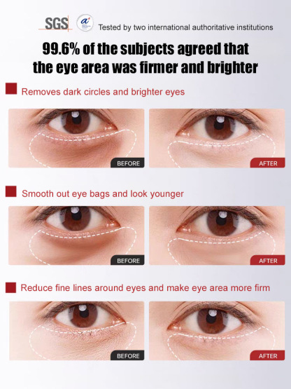 🌸🌸🌸【Herbal Anti-Wrinkle Firming Eye Cream】SGS-certified, reduces fine lines by 99.9%, dark circles by 98.7%, and eye bags by 96.3%. Contains herbs like ginseng and angelica, plus patented ingredients, for a refreshing and easily absorbed finish.