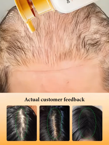 [Double Hair Volume] Anti-Hair Loss Shampoo