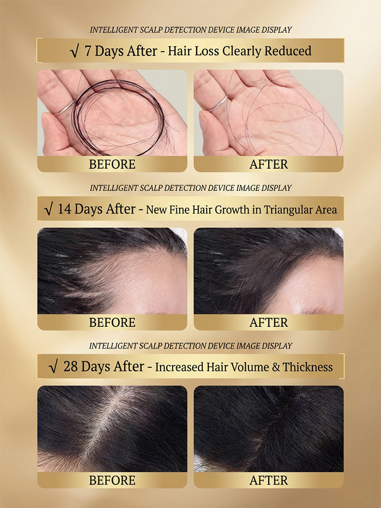 [Double Hair Volume] Anti-Hair Loss Shampoo