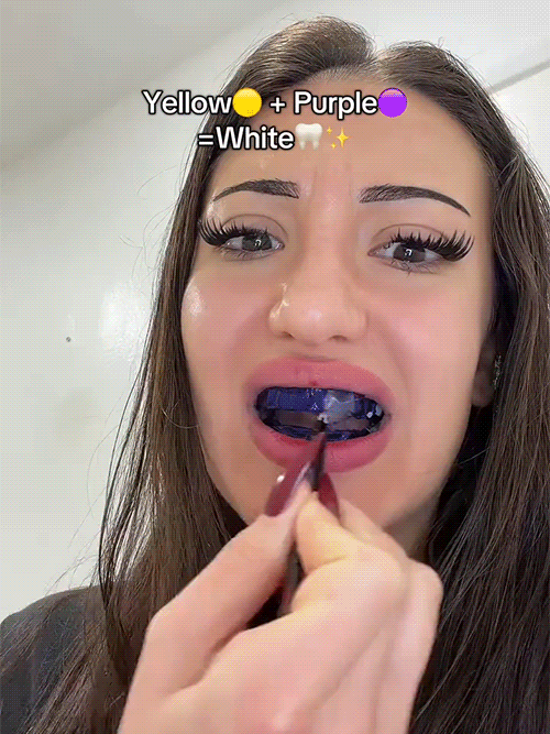 Purple teeth whitening strips, effectively whitens teeth in 3 days with light-based whitening technology, medical-grade cold light whitening, powerfully removes tea, tobacco, and coffee stains.