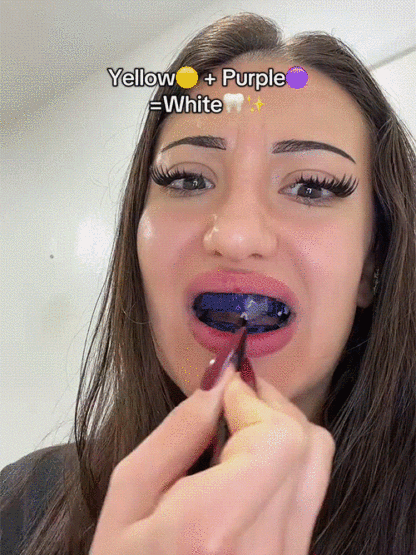 Purple teeth whitening strips, effectively whitens teeth in 3 days with light-based whitening technology, medical-grade cold light whitening, powerfully removes tea, tobacco, and coffee stains.