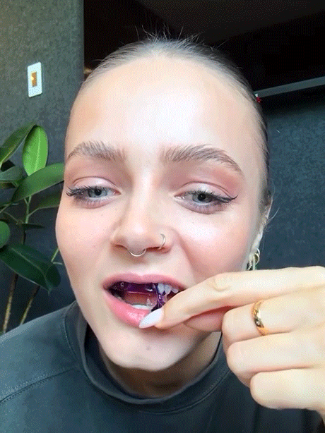 American dentists have developed second-generation purple-toned teeth whitening strips that whiten teeth in 30 minutes, remove 99% of stains in 7 days, are free of hydrogen peroxide and cause zero sensitivity, and are enamel-friendly.