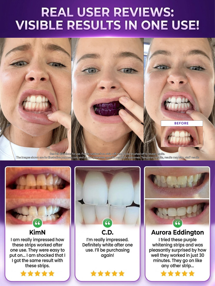 Purple teeth whitening strips, effectively whitens teeth in 3 days with light-based whitening technology, medical-grade cold light whitening, powerfully removes tea, tobacco, and coffee stains.