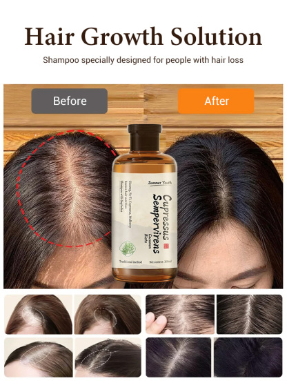[Double Hair Volume] Anti-Hair Loss Shampoo