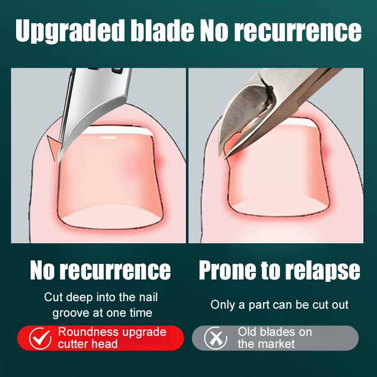 ✂️ Angled nail clipper set, solving paronychia troubles ✂️ ✅ The fine tip design reaches deep into the nail groove, eliminating hard-to-reach areas for ingrown toenails, trimming the nail bed without pulling or injuring the skin