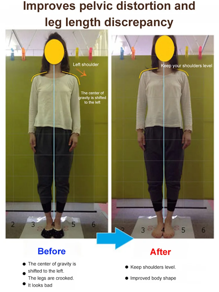 🔥🔥🔥Comfortable to wear all day, supports arch, corrects foot shape and various foot shapes, corrects O-shaped legs, very suitable for leisure and dating, purely handmade, will not wear out after 20 years