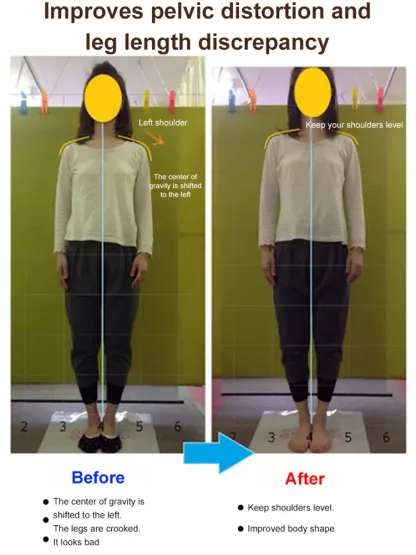 🔥🔥🔥Comfortable to wear all day, supports arch, corrects foot shape and various foot shapes, corrects O-shaped legs, very suitable for leisure and dating, purely handmade, will not wear out after 20 years