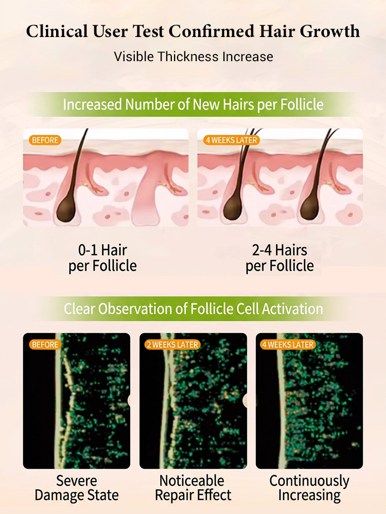 [Double Hair Volume] Anti-Hair Loss Shampoo