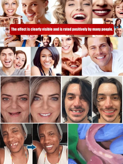 360-degree perfect smile.-Comfortable denture set that supports facial structure😁