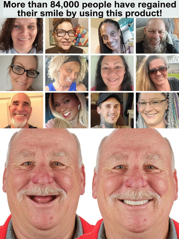 [Top Rated Customer] Natural Fit Denture Set