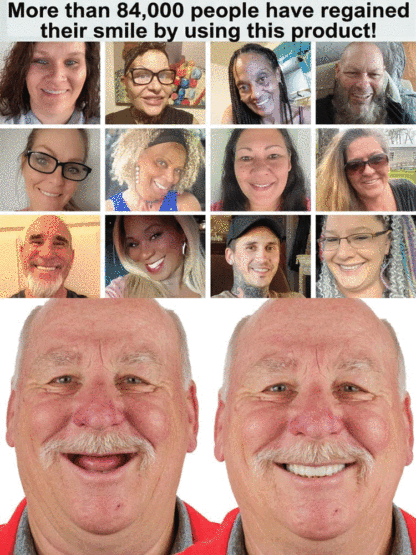 [Top Rated Customer] Natural Fit Denture Set