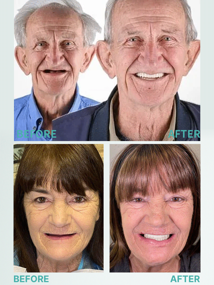 No need to go to the hospital🏥! Get "dental aesthetics" at home🌟! FDA certified, safe and non-toxic, safe for pregnant women🤰 and children👶!