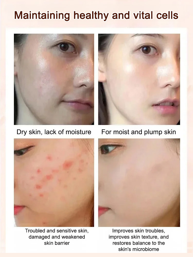 [Strengthen your body] Steamed figs