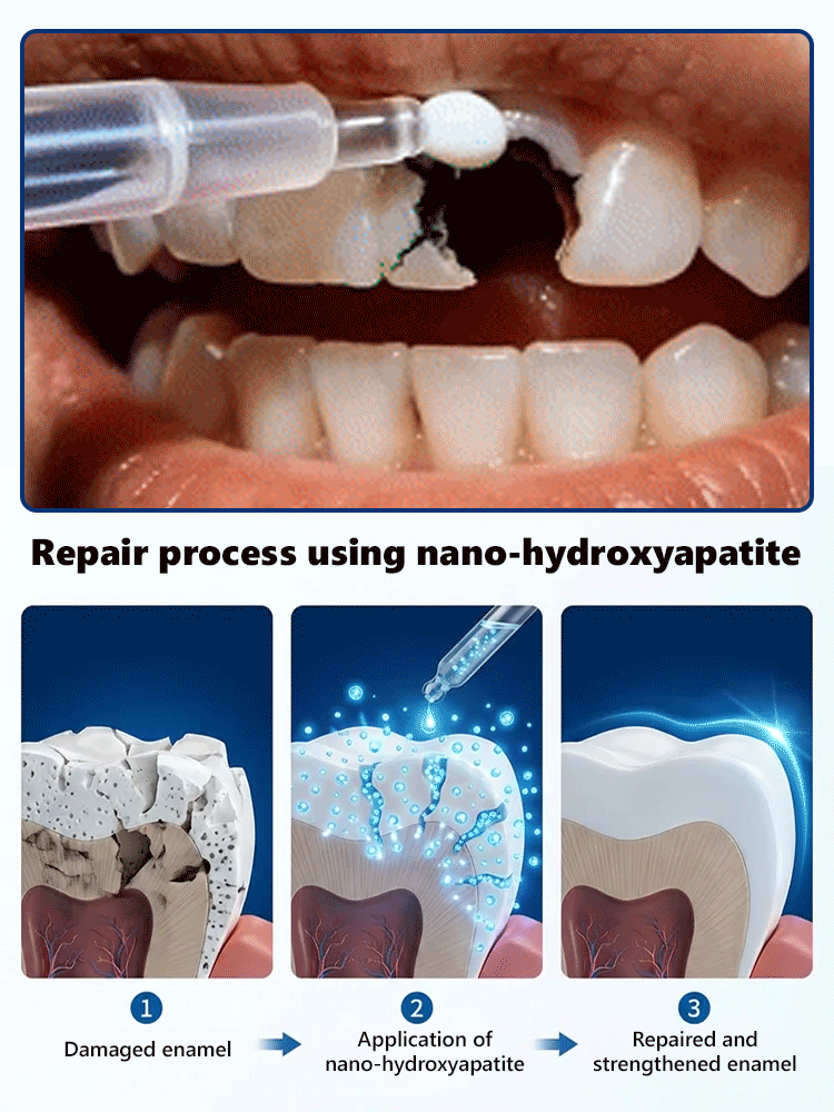 😱The truth dentists don't want you to know! Natural herbal extracts🌿 + exclusive bone regeneration factors, activating natural tooth root growth from the source, clinically proven 98% effective✅, helping you grow real teeth!