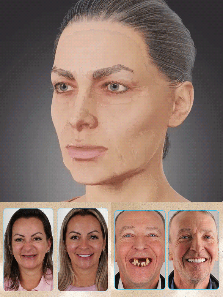 [Top Rated Customer] Natural Fit Denture Set