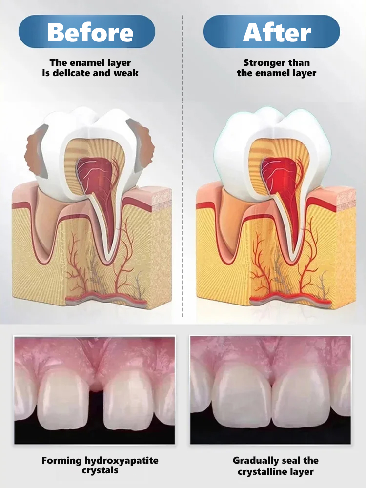 😱The truth dentists don't want you to know! Natural herbal extracts🌿 + exclusive bone regeneration factors, activating natural tooth root growth from the source, clinically proven 98% effective✅, helping you grow real teeth!