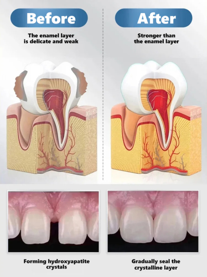😱The truth dentists don't want you to know! Natural herbal extracts🌿 + exclusive bone regeneration factors, activating natural tooth root growth from the source, clinically proven 98% effective✅, helping you grow real teeth!