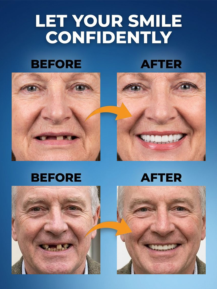 [Includes Portable Storage Box] Full Mouth Braces, Helping You Achieve a Beautiful Smile