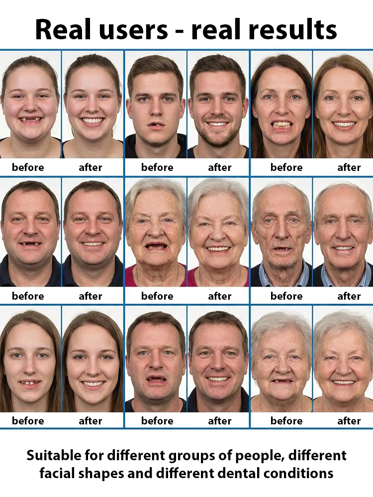 The Future of Dental Repair: No Clinic Visits, Perfectly Fitting Ultra-Comfortable Full Dentures.