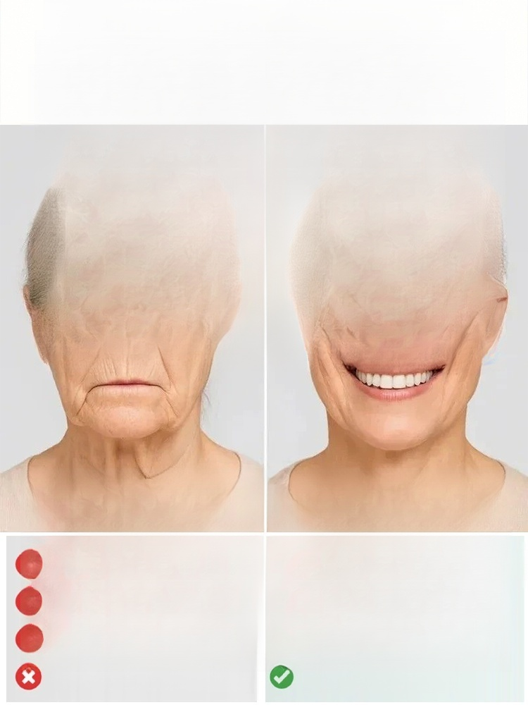 Natural Smile Customized Braces: A New Choice for Invisible Orthodontics, the Ultimate Solution for Dental Problems.